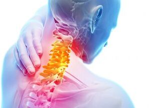 Pijn en schuilplaatsen in de cervicale zone met de derde graad van osteochondrose