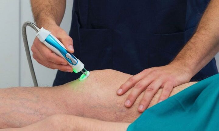 thermografie van het kniegewricht met artrose